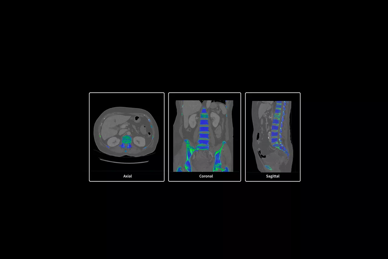 Spectral Auto Views video detail 1650x1100