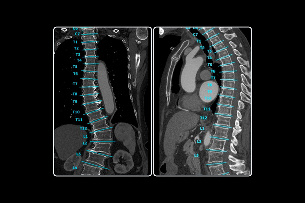 spine-auto-views-image-st-en