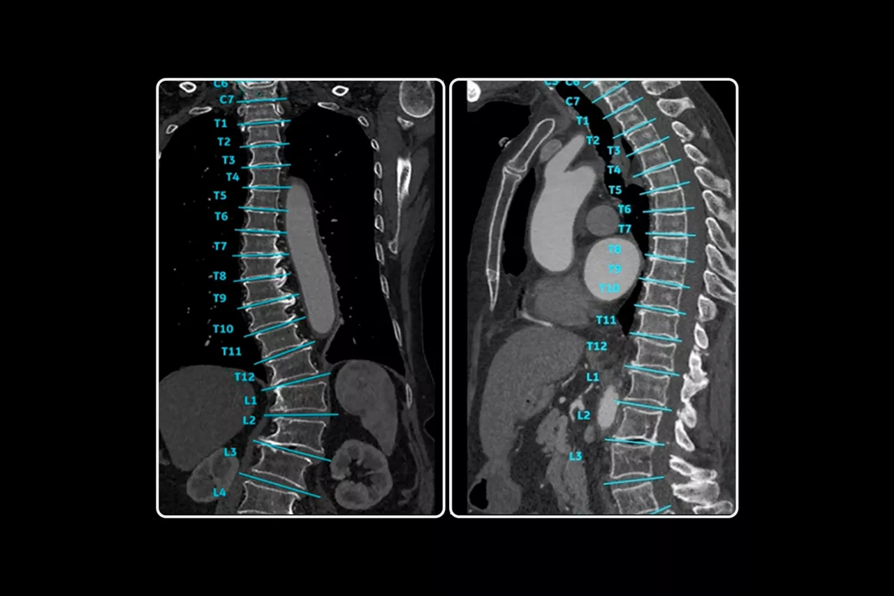 spine-auto-views-image-st-en