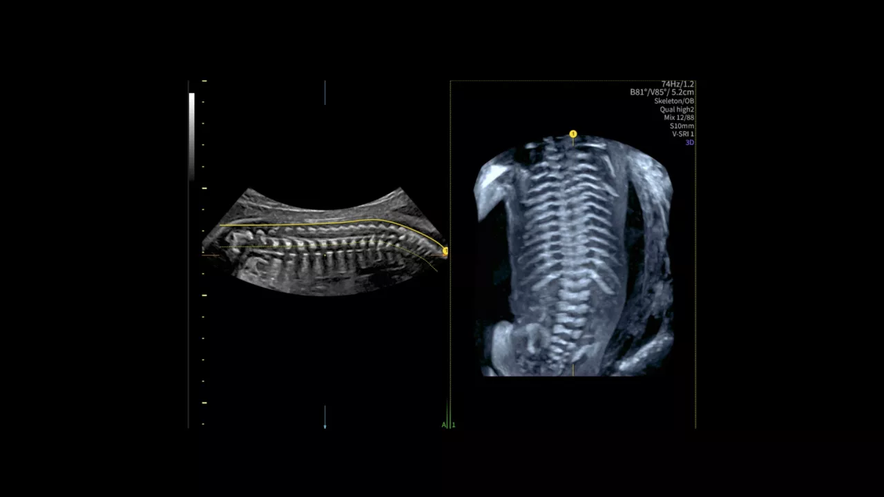 spine-trace-ci-en