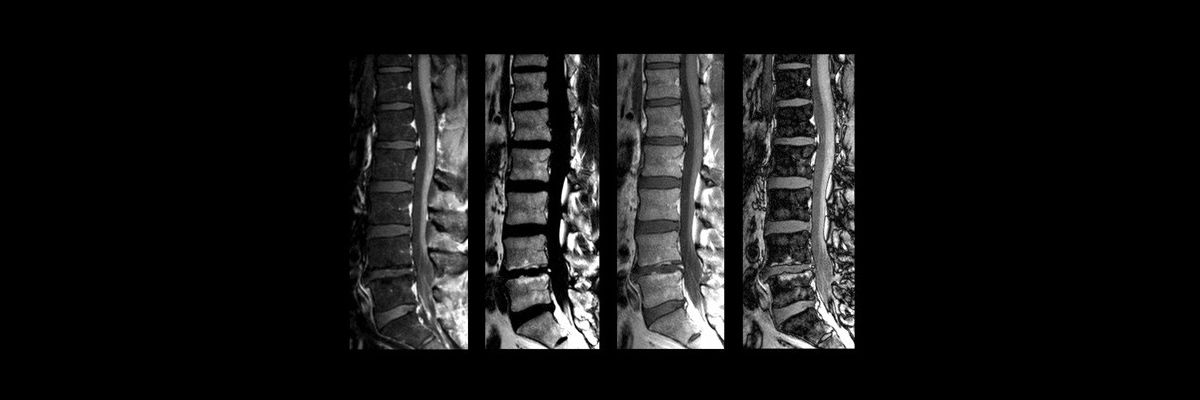 spine_ideal-1200