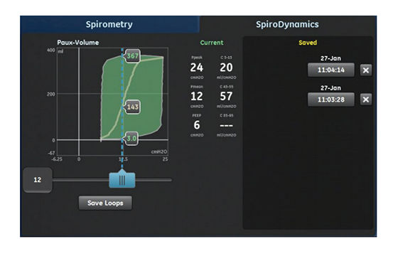 Spirodynamic-Guide-THMB_560x360_web_arc_global