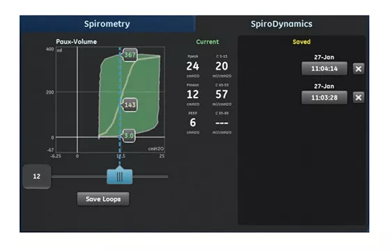 Spirodynamic-Guide-THMB_560x360_web_arc_global