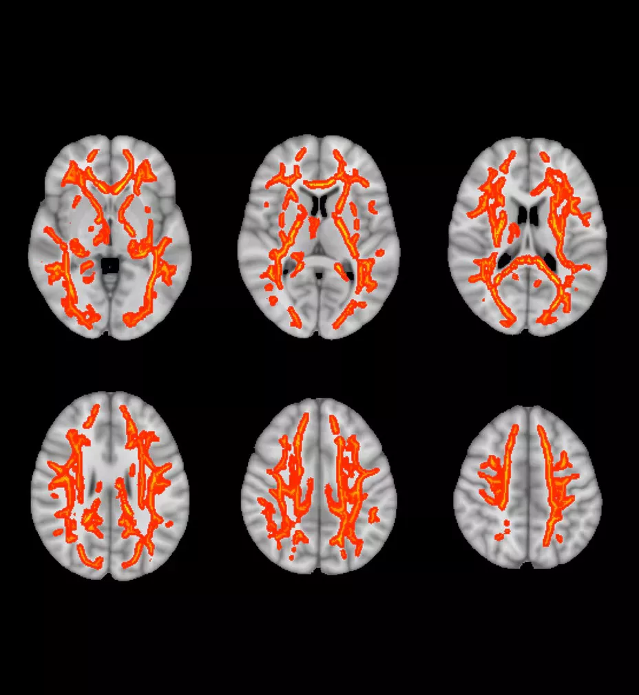 sports-medicine-concussion-and-mtbi-ci-en