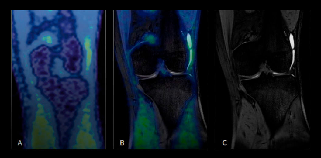 Sports-Medicine-Imaging-features-PET-MR-for-identifying-pain-generation-desktop