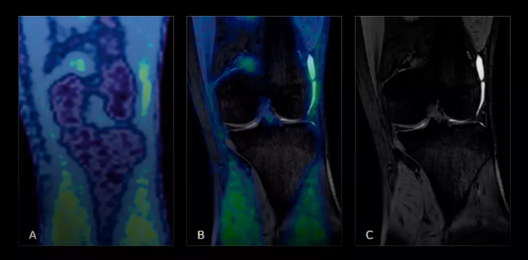Sports-Medicine-Imaging-features-PET-MR-for-identifying-pain-generation-desktop