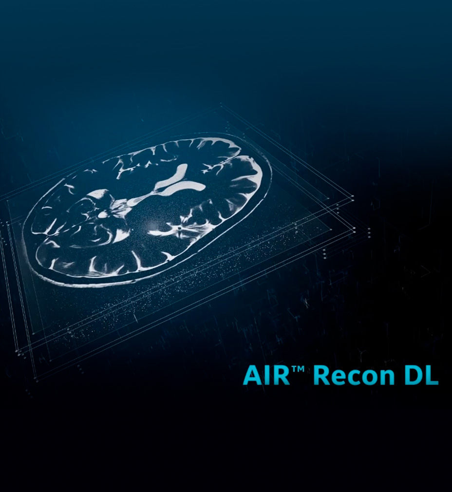 Sports-Medicine-Imaging-High-spatial-resolution-imaging