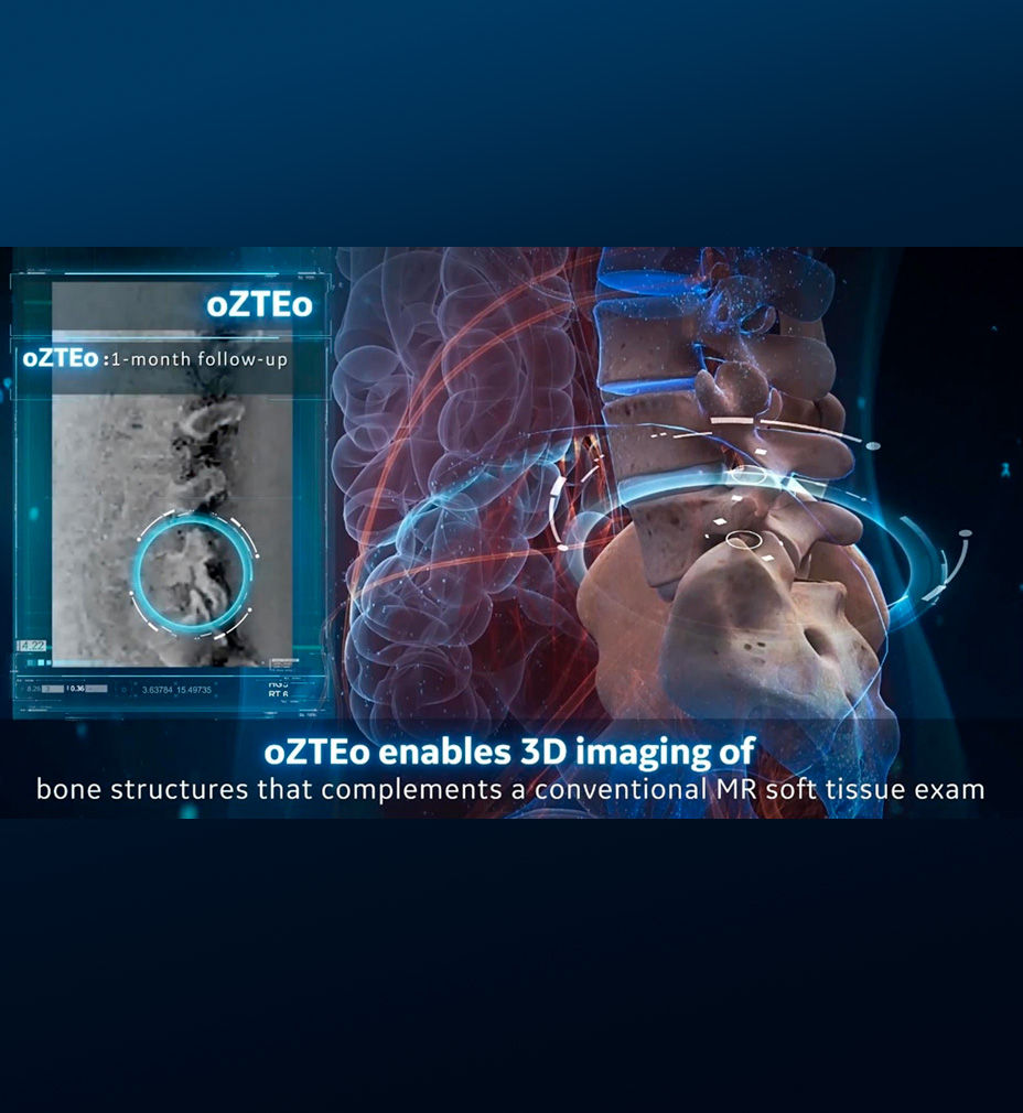 Sports-Medicine-Imaging-Osseous-and-soft-tissue-injuries