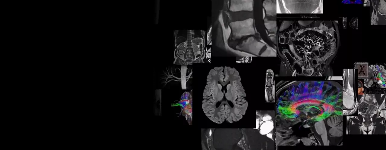 Sports Medicine Imaging | GE HealthCare (United States)