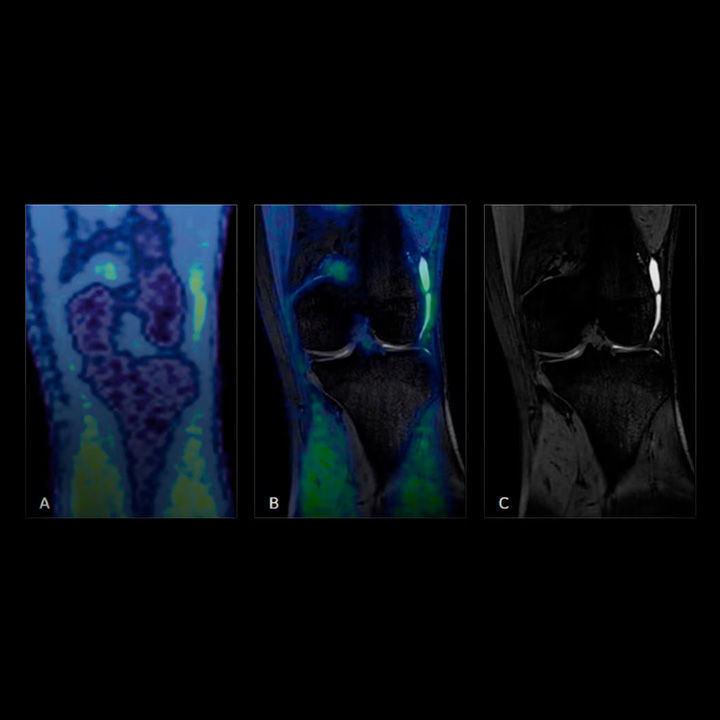 sports-medicine-msk-radiology-FeatureCardFull-1-ci-en