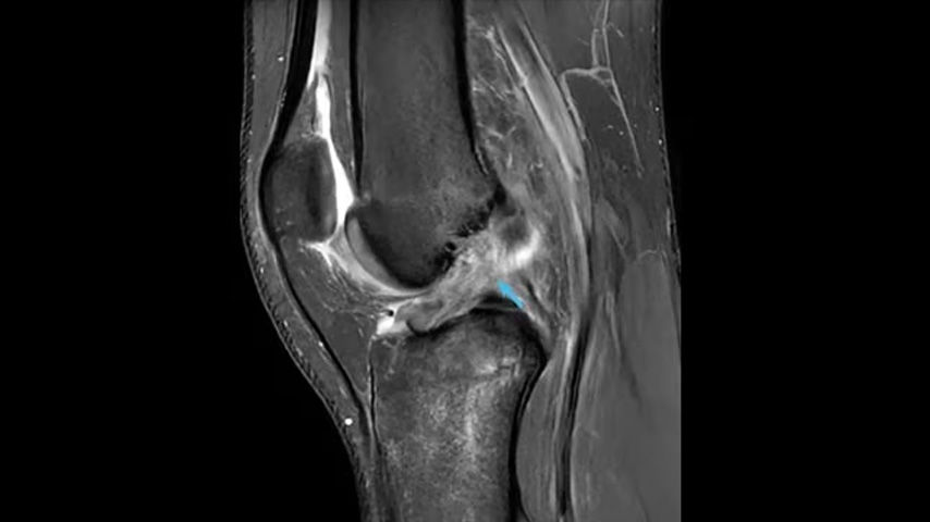 sports-medicine-msk-radiology-FeatureCardHalf-2-ci-en copy