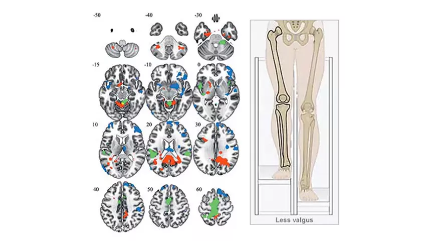 sports-medicine-msk-radiology-FeatureCardHalf-2-ci-en