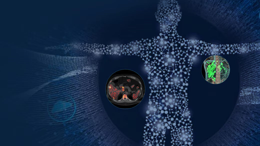 02-RelatedContent-Fortifying-the-pathway-to-hope-with-theranostics