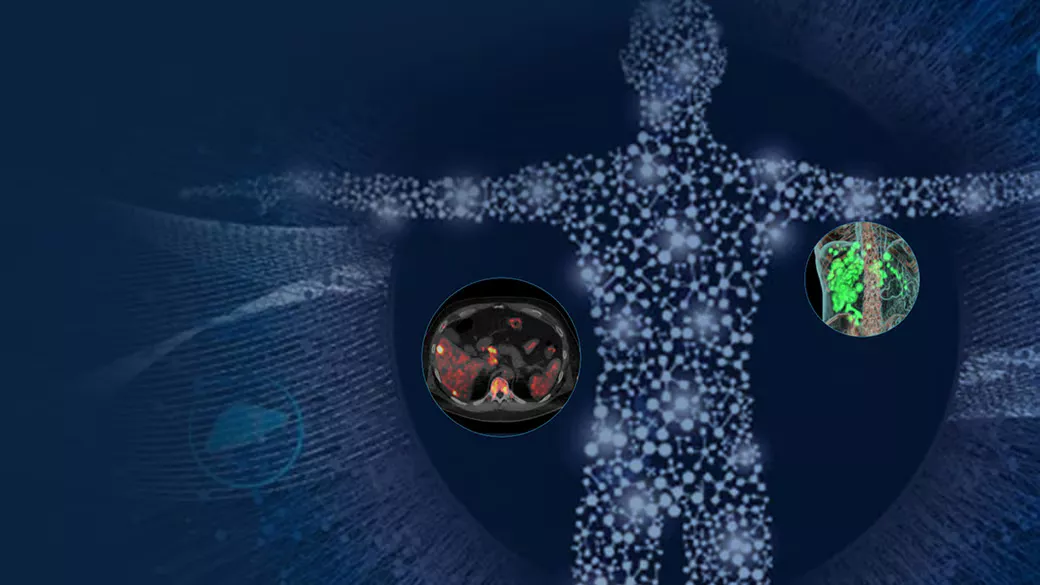 02-RelatedContent-Fortifying-the-pathway-to-hope-with-theranostics