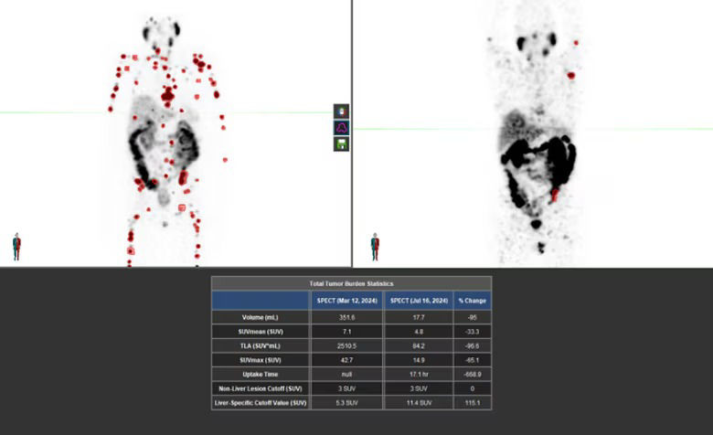starguide-theranostics-excellence1-st-en