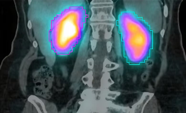 starguide-theranostics-excellence3-st-en