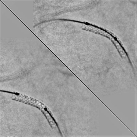 StentViz