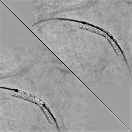 StentViz