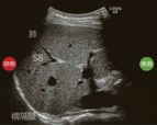 Step2_Liver_Q2_Page3_Image