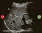 Step2_Liver_Q2_Page3_Image