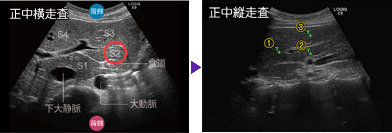 Step2_Liver_Q3_Page5_Image_R2
