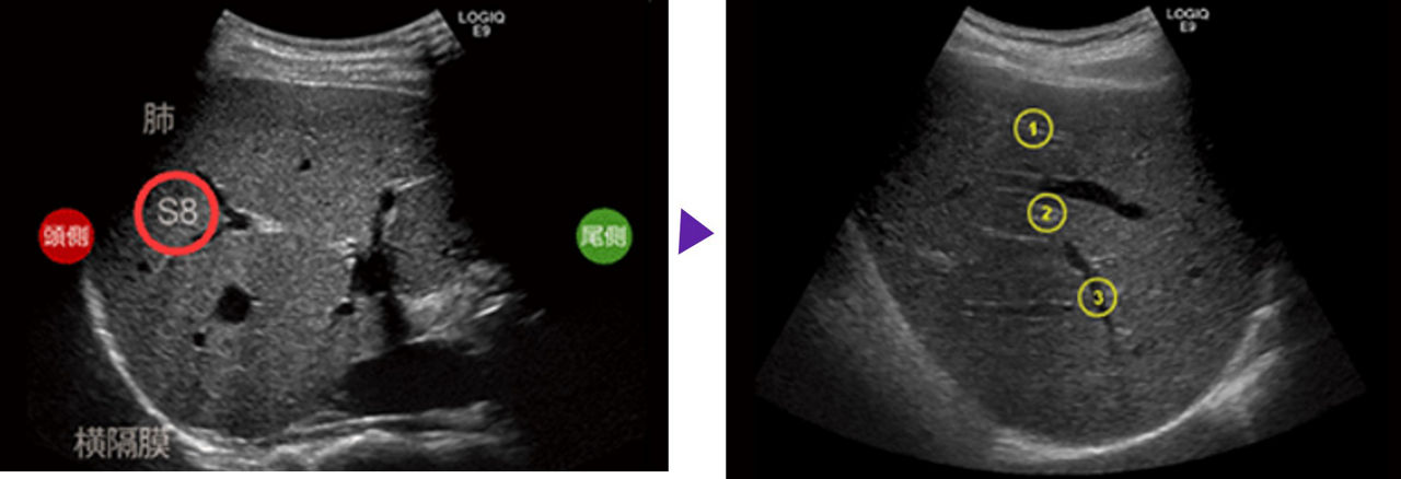 Step2_Liver_Q4_Page7_Image_R2