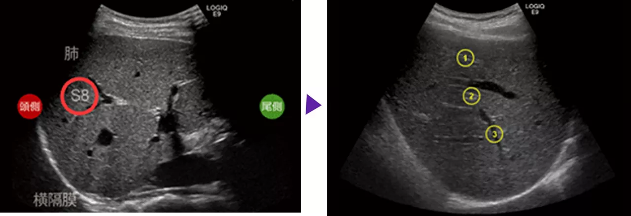 Step2_Liver_Q4_Page7_Image_R2