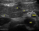 Step2_suizo_Q4_Image