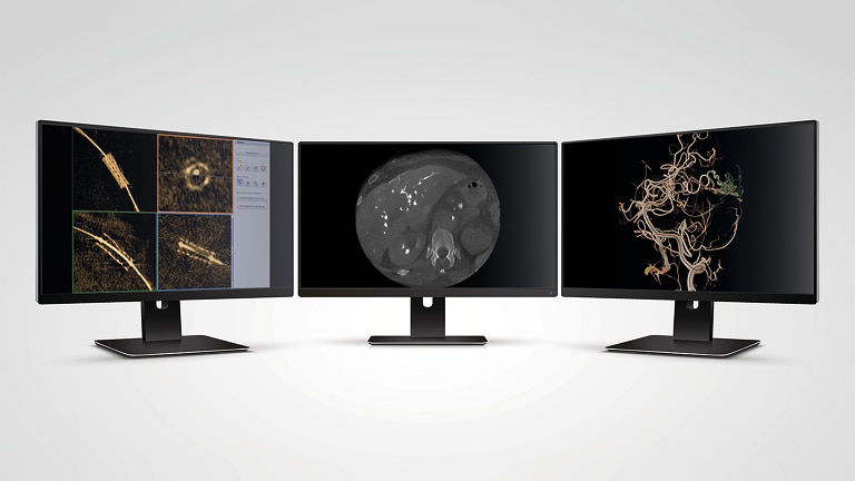 story-gallery-3-st-en