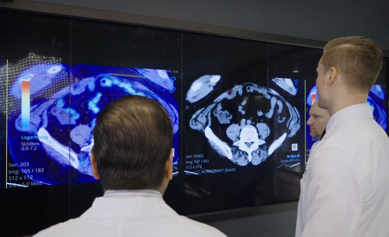 Story-Gallery01-Theranostics-Patient-qualification780x476