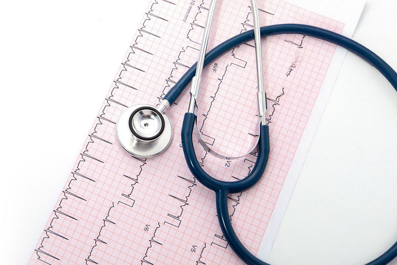 stress-and-exercise-testing-herosticky-st-en