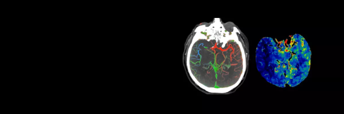 Stroke-Solutions-1200x400