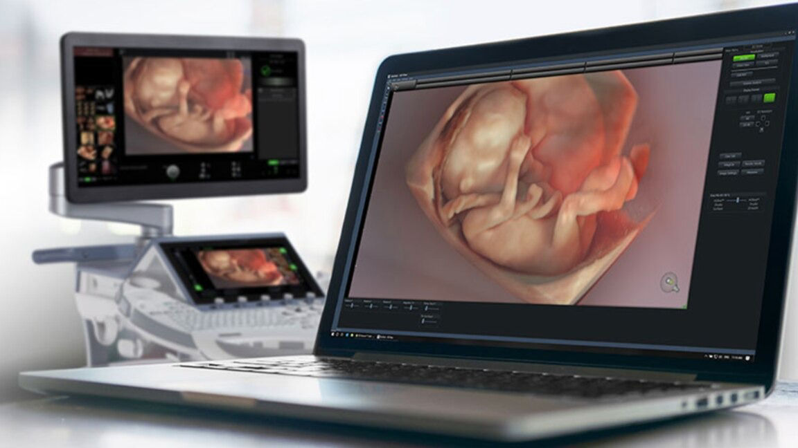 support-excellence-4dview-ci-en