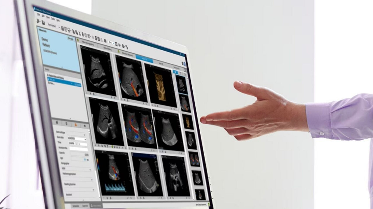 support-excellence-viewpoint-st-en