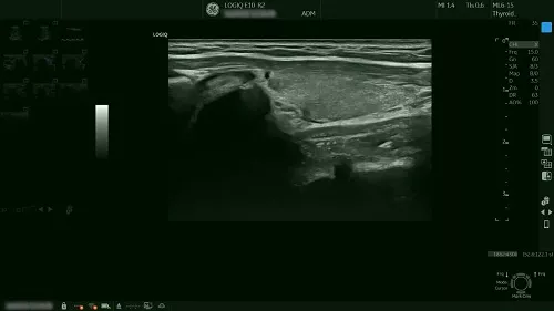 Surface Organs