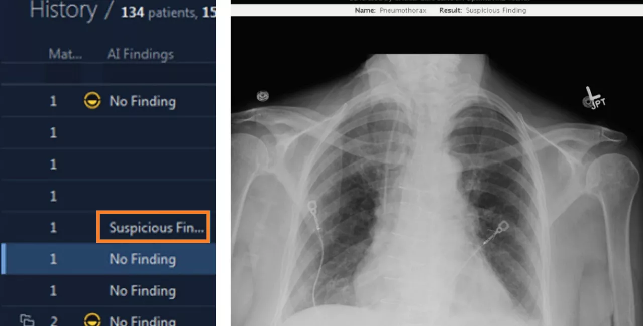 Suspicious Finding 890x450