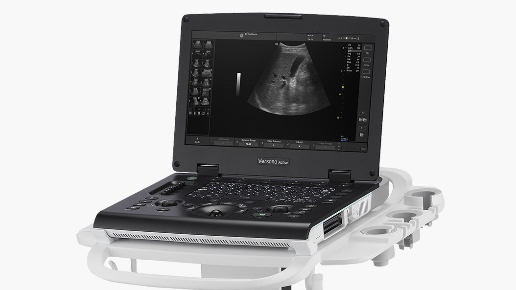 Versana Active Portable Ultrasound