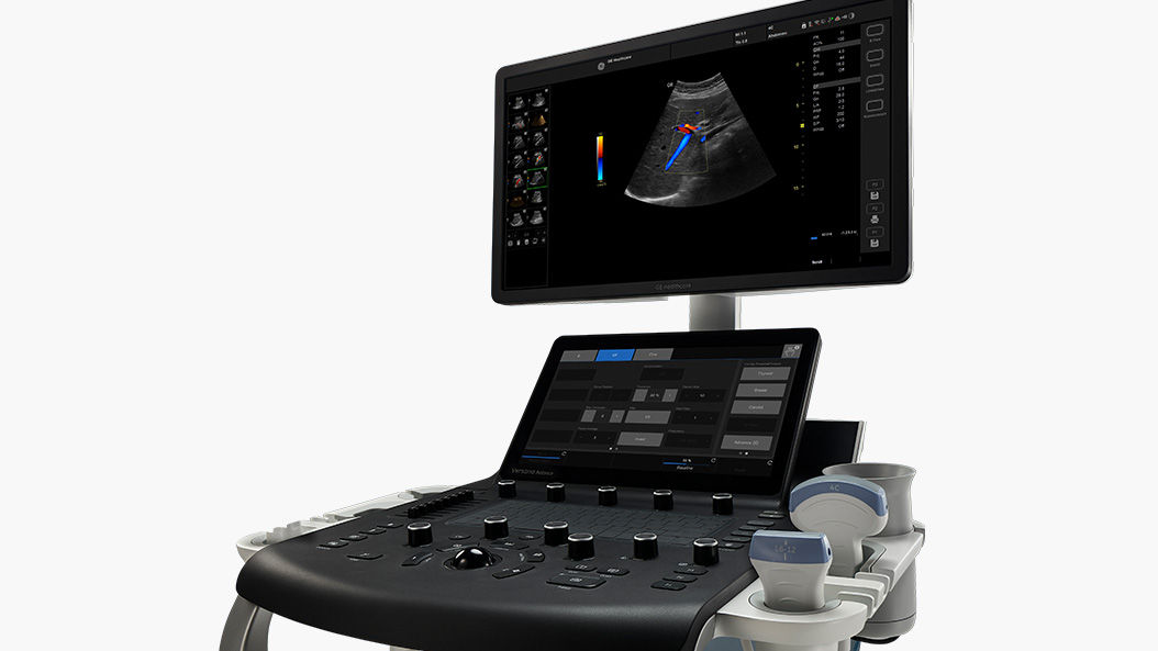 Versana Balance Ultrasound