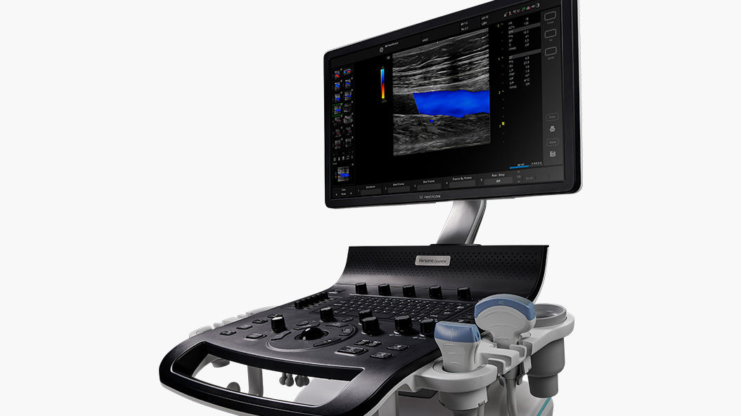 Versana Essential Ultrasound System