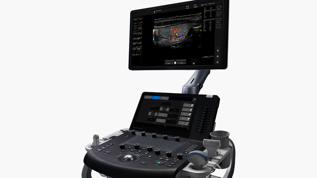 Versana Premier Ultrasound System