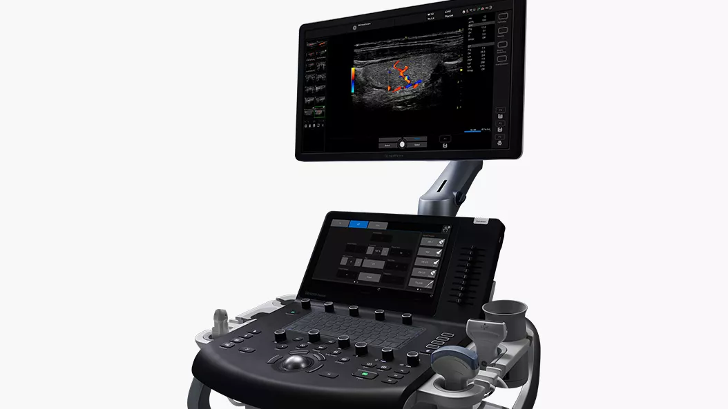 Versana Premier Ultrasound System
