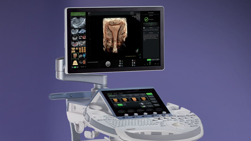 Voluson E6 Women's Health Ultrasound System