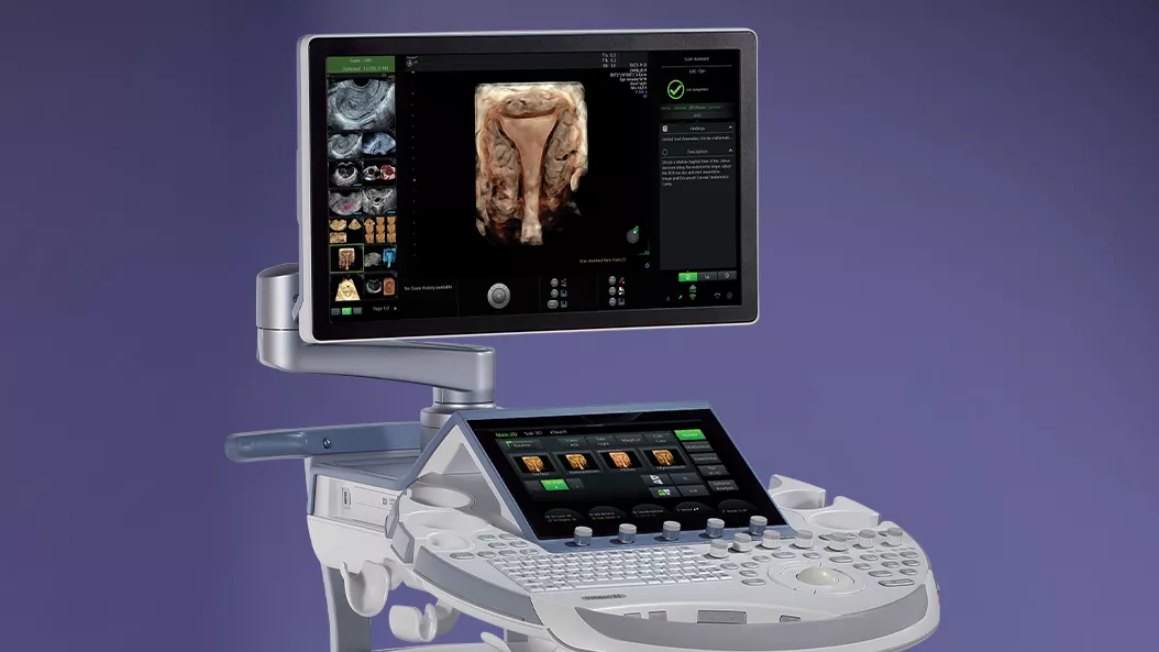 Voluson E6 Women's Health Ultrasound System