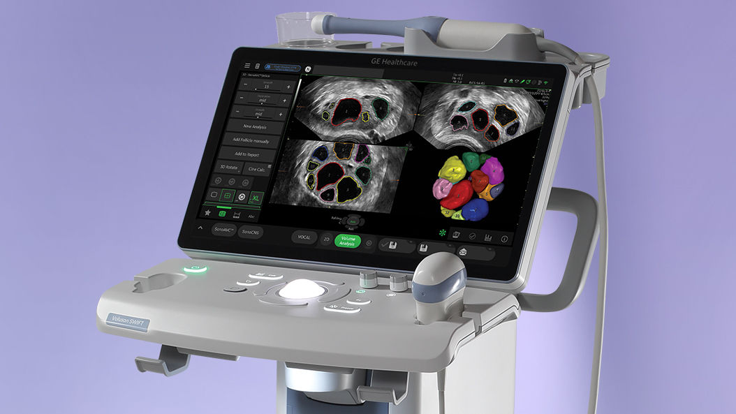 Voluson SWIFT Women's Health Ultrasound System
