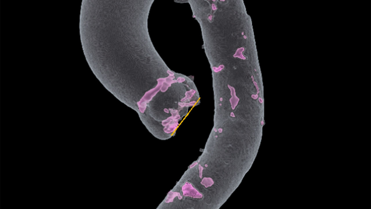 CARESCAPE spirometry accessory.