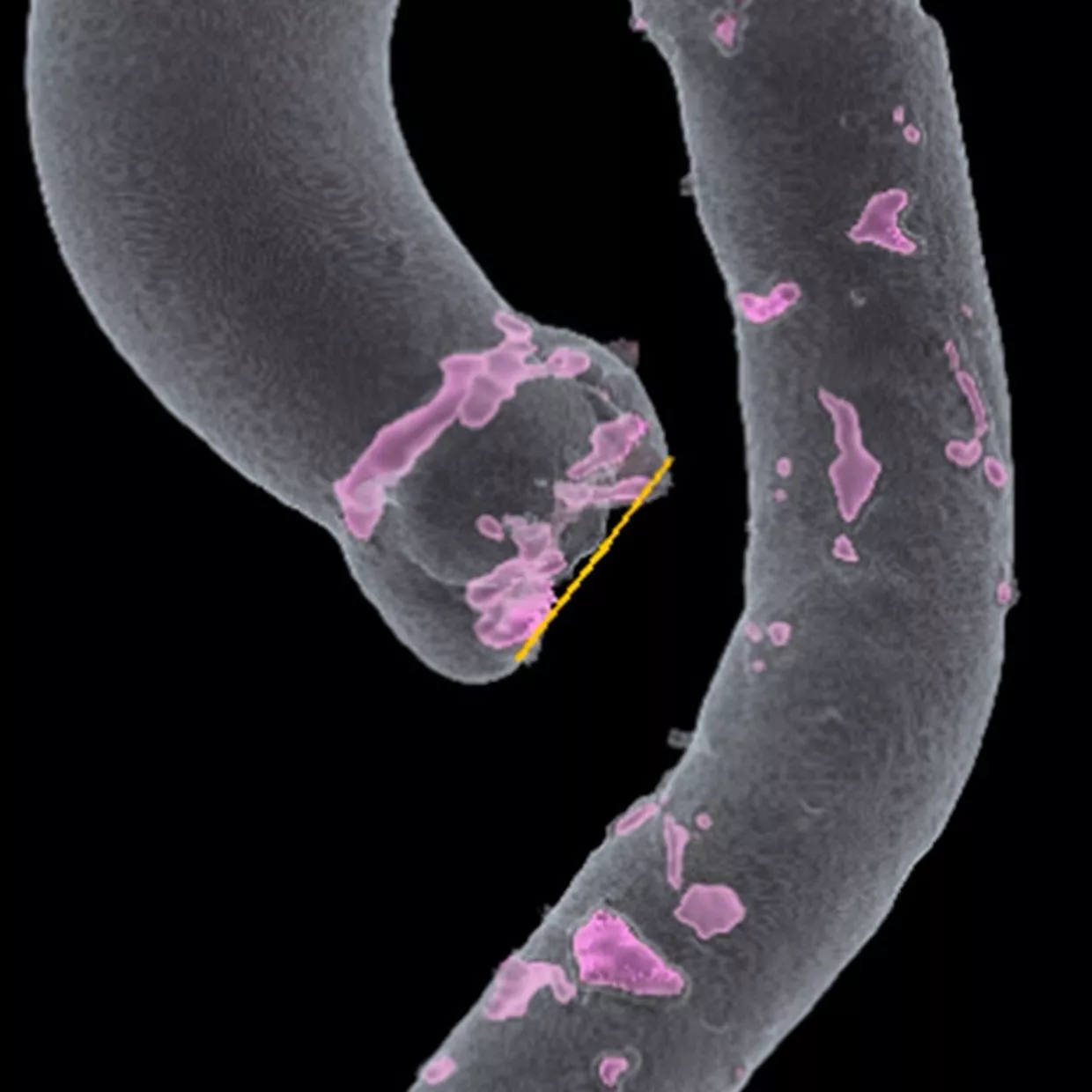 tavi-assess-aortic-root-670x670