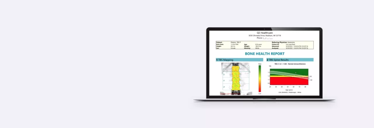tbs-software-features-full-width-desktop1