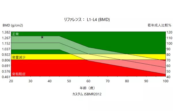 骨粗鬆症の予防と治療ガイドライン2025年版 について