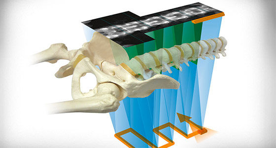 Bone Health and Metabolic Health