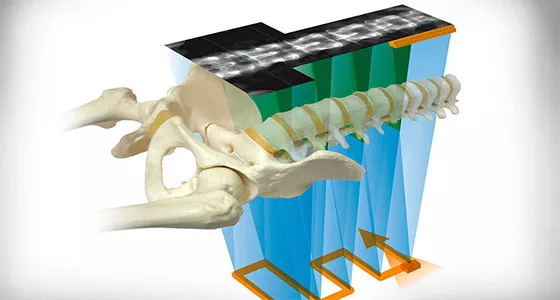 Bone Health and Metabolic Health